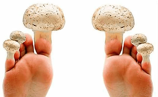 Pilz auf den Nägeln