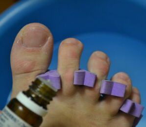 Vorbereitung zur Behandlung der Nägel mit Anti-Pilz-Tropfen